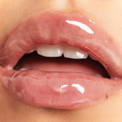 Nartasia™ – Ajak Volumen Hatás